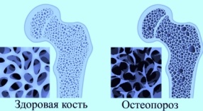Кальций Тяньши